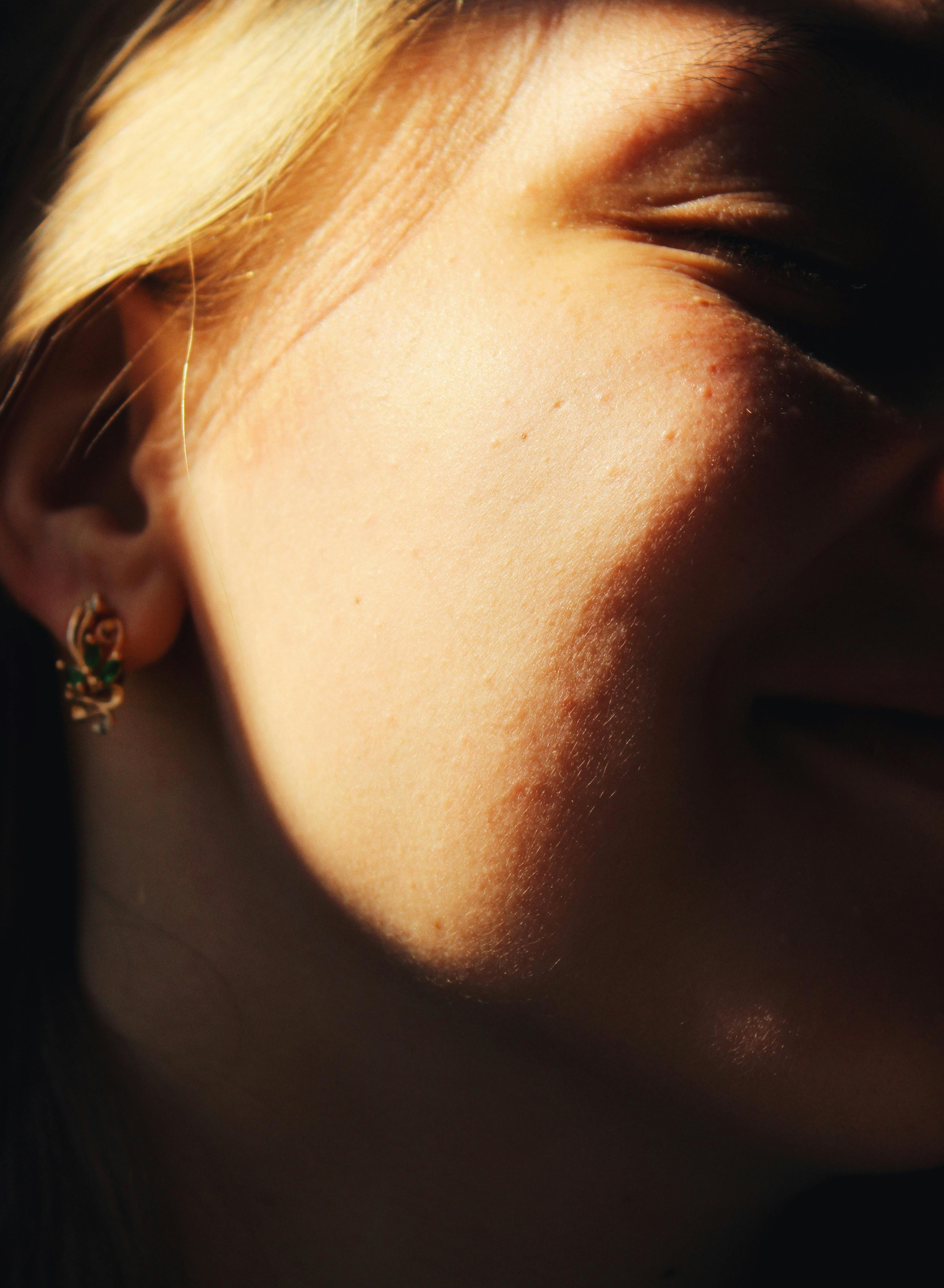 Luma Skin project visual